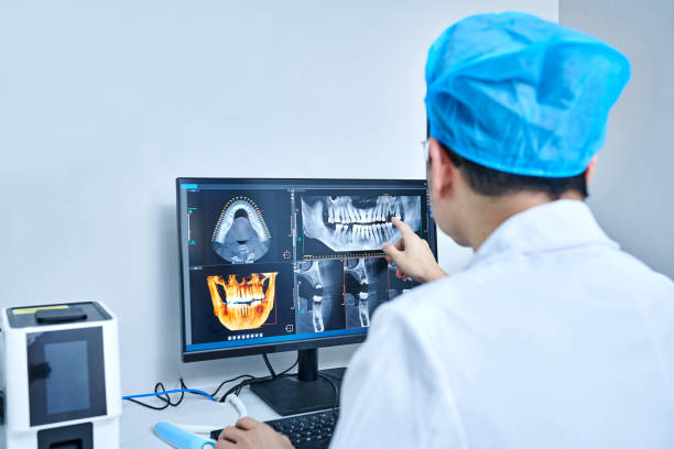 Best Knocked-Out Tooth (Avulsed Tooth) Treatment in Normandy, MO